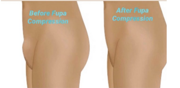 Fupa Compression Pad